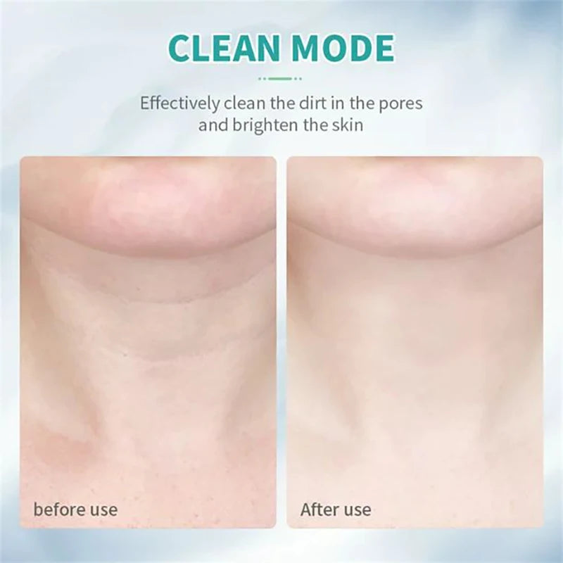 Ems neck face lifter device by Bys-store with LED photon therapy for skin tightening, anti-wrinkle, and double chin reduction.